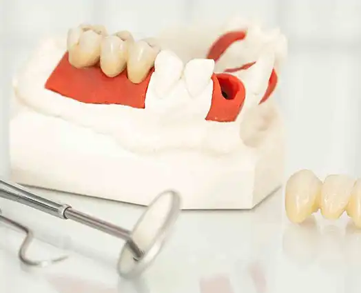 Dental Crowns Post Treatment Care