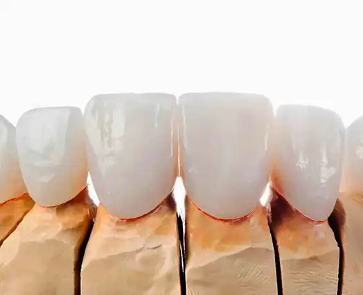 Veneers Pre-Operative Instructions